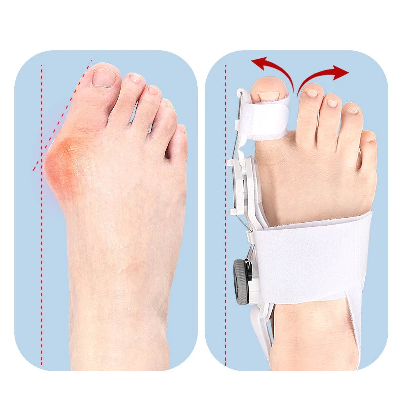 1PC Bunion Corrector Unisex